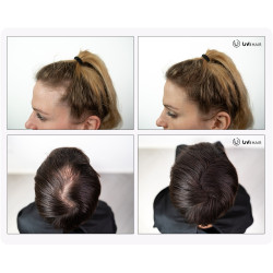UVI Hair Fiber, AUBURN (large 27.5 g, up to 50 applications) UVI Hair Fiber, AUBURN (large 27.5 g, up to 50 applications)