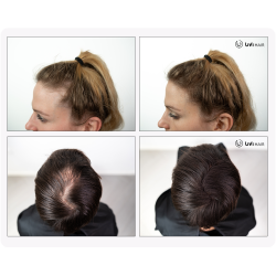 UVI Hair Fiber, DARK BROWN (large 27.5 g, up to 50 applications) UVI Hair Fiber, DARK BROWN (large 27.5 g, up to 50 applications)
