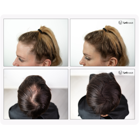 UVI Hair Fiber Dark Brown large 27.5g bottle of natural keratin hair thickening fibres, suitable for men and women, up to 50 applications