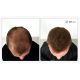 UVI Hair Fiber Dark Brown large 27.5g bottle of natural keratin hair thickening fibres, suitable for men and women, up to 50 applications