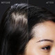 Toppik Hair Fiber Medium Brown large 27.5g bottle of keratin hair building fibers for thinning hair, suitable for men and women